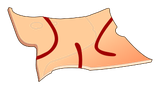 Peau de Don Dorgan